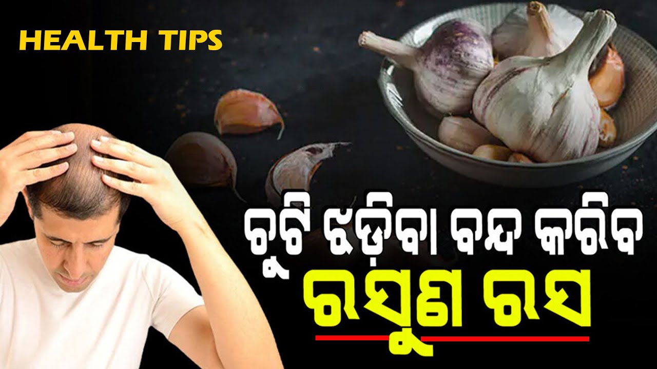 Garlic Paste for Hair Lossin odia